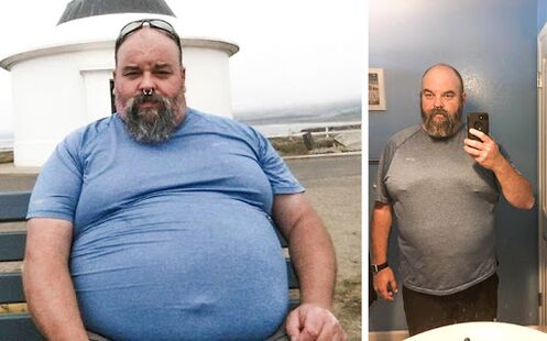 Foto vor und nach dem Verlauf von Keto Probiox, die Erfahrung mit der Verwendung von Kapseln mit einem Migter in Venedig